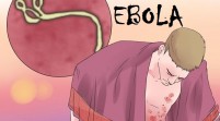 Demam Belum Tentu Ebola